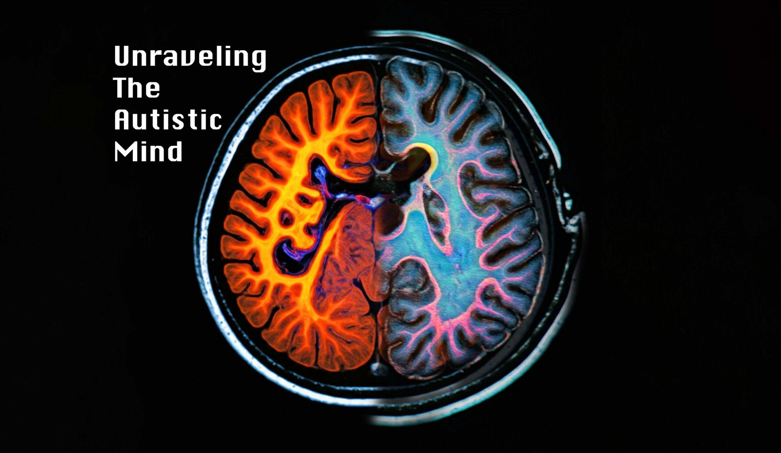 Unraveling the Autistic Mind: A Journey Through Multimodal Neuro-Imaging